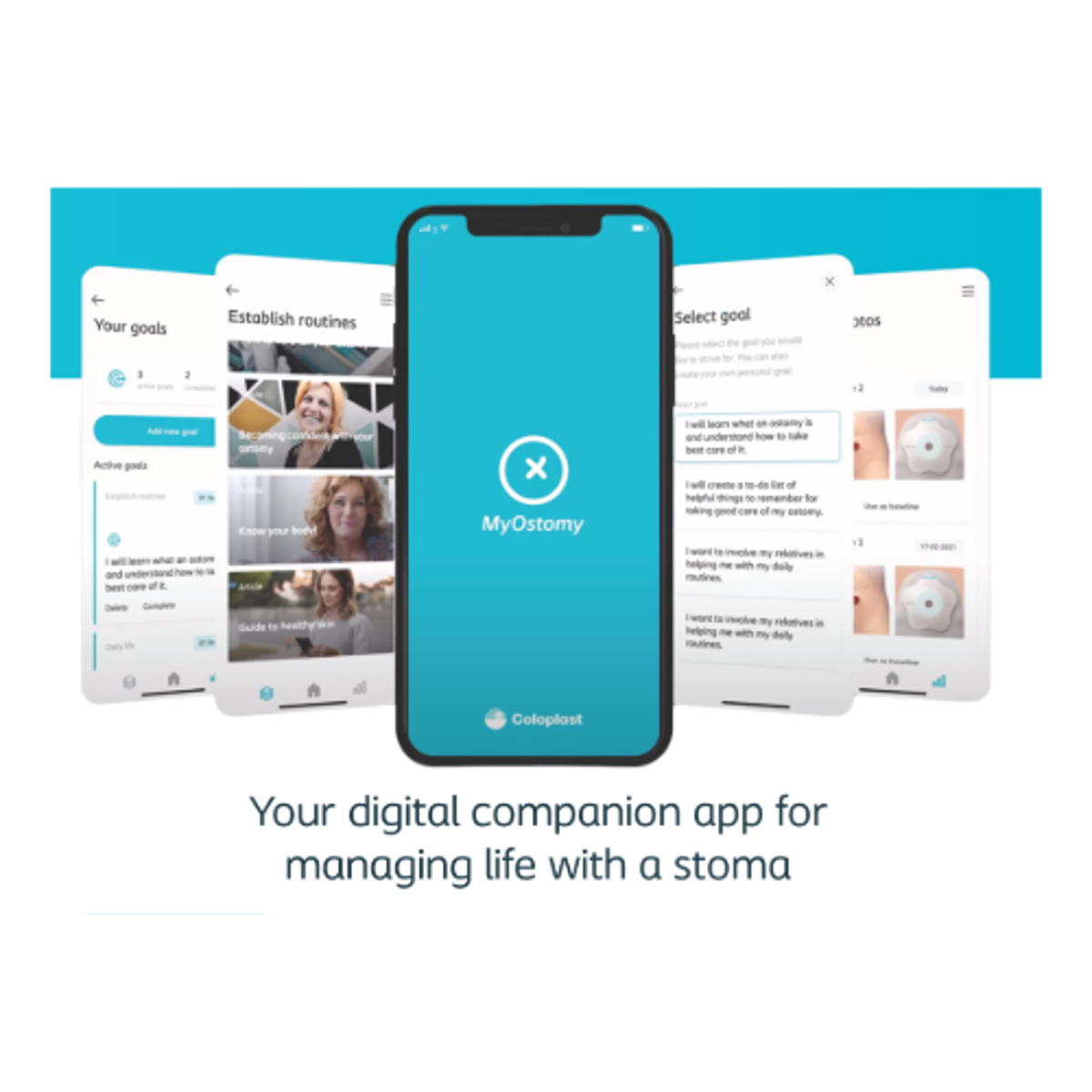 MyOstomy is the perfect tool to establish healthy stoma care routines 